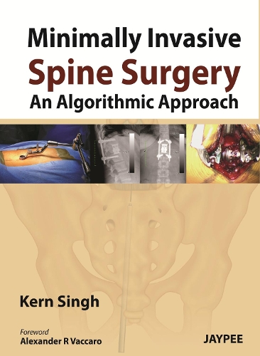 Бумажная книга «Minimally Invasive Spine Surgery: An Algorithmic Approach», автор Керн Сингх - фото №1