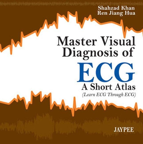 Бумажная книга «Master Visual Diagnosis of ECG: A Short Atlas (Learn ECG through ECG)», авторов Рен Цзян Хуа, Шахзад Хан - фото №1