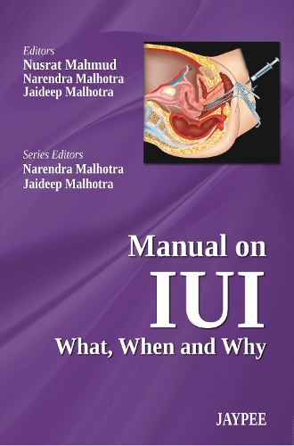 Бумажная книга «Manual on IUI: What, When and Why», авторов Малхотра Джаидип, Нарендра Мальхотра, Нусрат Махмуд - фото №1