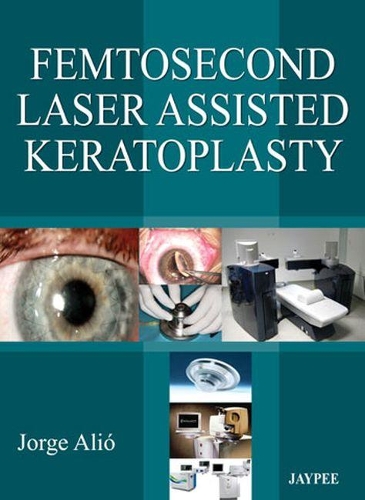 Бумажная книга «Femtosecond Laser Assisted Keratoplasty», автор Хорхе Л Алио - фото №1