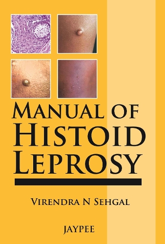 Бумажная книга «Manual of Histoid Leprosy», авторов Говинд Шривастава, Вирендра Н. Сехгал - фото №1