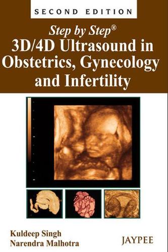 Бумажная книга «Step by Step: 3D/4D Ultrasound in Obstetrics, Gynecology and Infertility», авторов Кулдип Сингх, Нарендра Мальхотра - фото №1