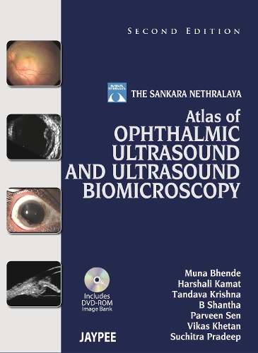 Паперова книга «Atlas of Ophthalmic Ultrasound and Ultrasound Biomicroscopy», авторів Б Шантха, Харшалі Камат, Муна Бхенде, Парвін Сен, Сучітра Прадіп, Тандава Крішна, Вікас Кхетан - фото №1