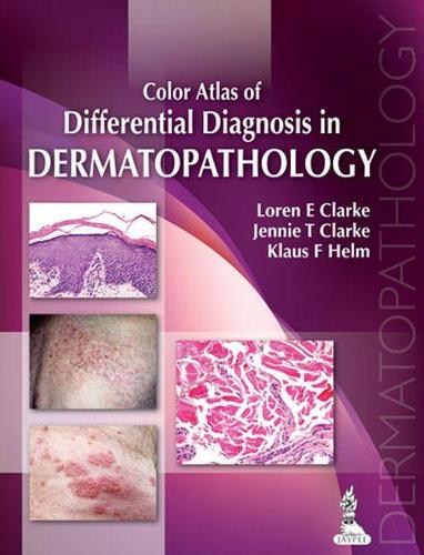 Бумажная книга «Color Atlas of Differential Diagnosis in Dermatopathology», авторов Дженни Т. Кларк, Клаус Ф Хельм, Лорен Э. Кларк - фото №1