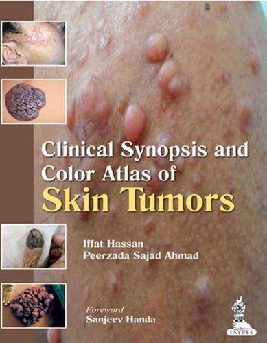 Бумажная книга «Clinical Synopsis and Color Atlas of Skin Tumors», авторов Иффат Хасан, Пеерзада Саджад Ахмад - фото №1