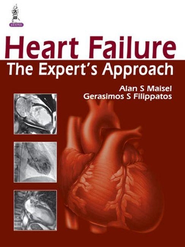 Бумажная книга «Heart Failure: The Expert's Approach», авторов Алан С. Майзель, Герасимос Филиппатос - фото №1