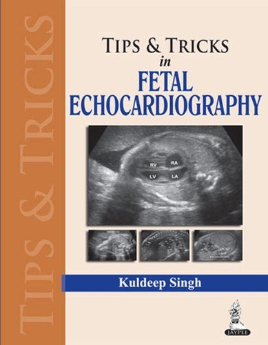 Паперова книга «Tips & Tricks in Fetal Echocardiography», автор Кулдіп Сінгх - фото №1