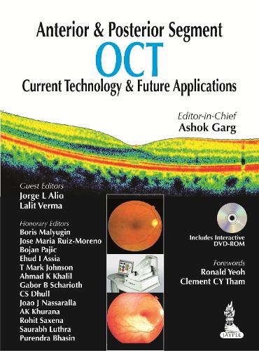 [object Object] «Anterior & Posterior Segment OCT: Current Technology & Future Applications», автор Ашок Гарг - фото №1