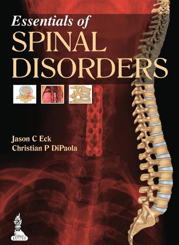 Бумажная книга «Essentials of Spinal Disorders», авторов Кристиан П. Ди Паола, Джейсон Си Экк - фото №1