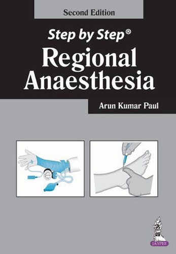 Паперова книга «Step by Step: Regional Anaesthesia», автор Пол Арун Кумар - фото №1
