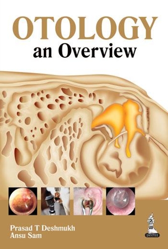 Паперова книга «Otology: an Overview», авторів Ансу Сем, Прасад Т. Дешмукх - фото №1