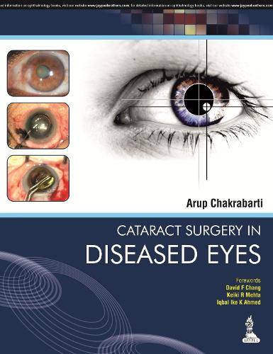 Бумажная книга «Cataract Surgery in Diseased Eyes», автор Аруп Чакрабарти - фото №1
