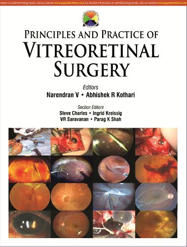 Паперова книга «Principles and Practice of Vitreoretinal Surgery», авторів Абхішек Котарі, Нарендра В - фото №1