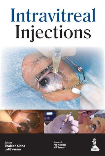 Паперова книга «Intravitreal Injections», авторів Лаліт Верма, Шалабх Сінха - фото №1
