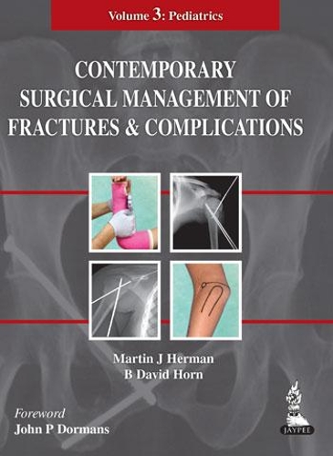 Паперова книга «Contemporary Surgical Management of  Fractures and Complications: Volume 3 - Pediatrics», авторів B Девід Хорн, Мартін Дж. Герман - фото №1