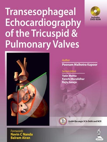 Паперова книга «Transesophageal Echocardiography of the Tricuspid & Pulmonary Valves», автор Пунам Малхотра Капур - фото №1