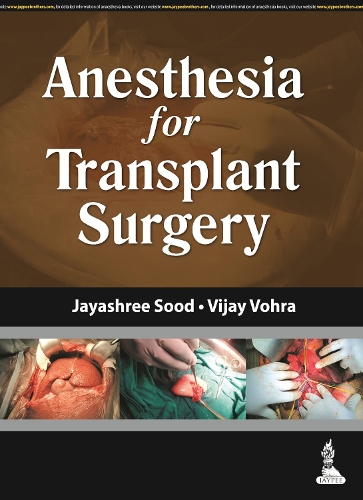 Бумажная книга «Anesthesia for Transplant Surgery», авторов Джаяшри Суд, Виджай Вохра - фото №1