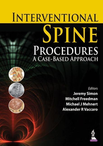 Бумажная книга «Interventional Spine Procedures: A Case-Based Approach», авторов Александр Р Ваккаро, Джереми Саймон, Майкл Дж. Мехнерт, Митчелл Фридман - фото №1