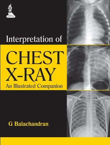 Бумажная книга «Interpretation of Chest X-Ray: An Illustrated Companion», автор Г. Балачандран - фото №1