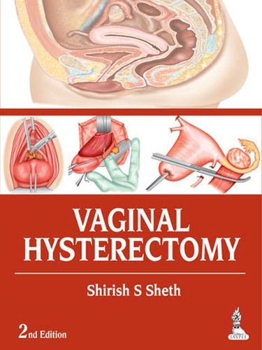 Бумажная книга «Vaginal Hysterectomy», автор Шириш С. Шет - фото №1