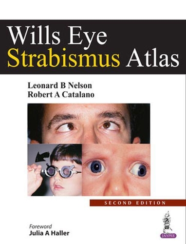 Паперова книга «Wills Eye Strabismus Atlas», авторів Леонард Б. Нельсон, Роберт А. Каталано - фото №1