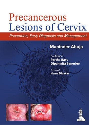 Бумажная книга «Precancerous Lesions of Cervix: Prevention, Early Diagnosis and Management», автор Маниндер Ахуджа - фото №1