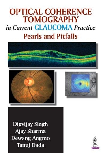 Бумажная книга «Optical Coherence Tomography in Current Glaucoma Practice: Pearls and Pitfalls», авторов Аджай Шарма, Деванг Ангмо, Дигвиджай Сингх, Танудж Дада - фото №1