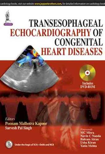Паперова книга «Transesophageal Echocardiography of Congenital Heart Diseases», авторів Пунам Малхотра Капур, Сарвеш Пал Сінгх - фото №1