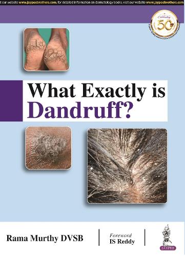 Паперова книга «What Exactly is Dandruff?», автор Рама Мурті - фото №1