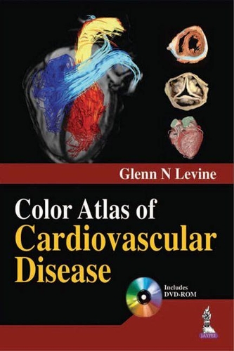 Бумажная книга «Color Atlas of Cardiovascular Disease», автор Гленн Н. Левин - фото №1