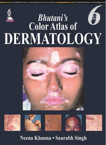 Паперова книга «Bhutani’s  Color Atlas of Dermatology», автор Ніна Кханна - фото №1