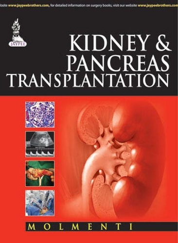 Паперова книга «Kidney & Pancreas Transplantation», автор Ернесто Помпео Молменті - фото №1