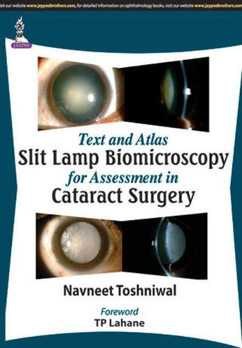 Бумажная книга «Text and Atlas: Slit Lamp Biomicroscopy for Assessment in Cataract Surgery», автор Навнит Тошнивал - фото №1