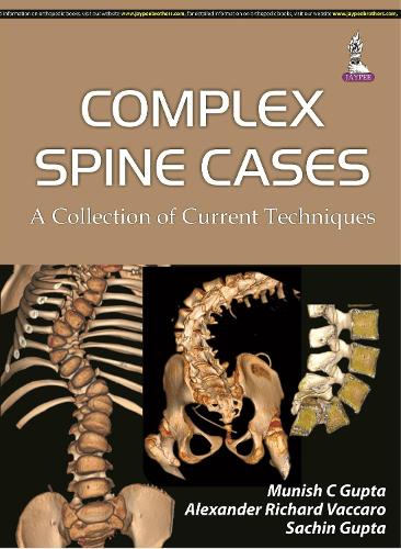 Паперова книга «Complex Spine Cases: A Collection of Current Techniques», авторів Александр Р. Ваккаро, Муніш К. Гупта, Сачін Гупта - фото №1