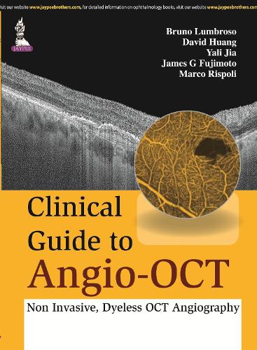 Бумажная книга «Clinical Guide to Angio-OCT: Non Invasive, Dyeless OCT Angiography», авторов Бруно Лумброзо, Дэвид Хуанг, Джеймс Фуджимото, Марко Рисполи, Яли Цзя - фото №1