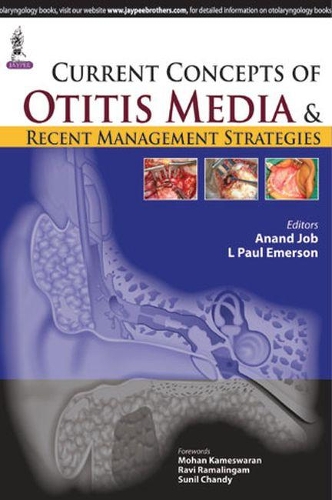 Паперова книга «Current Concepts of Otitis Media and Recent Management Strategies», авторів Ананд Джоб, Пол Л. Емерсон - фото №1