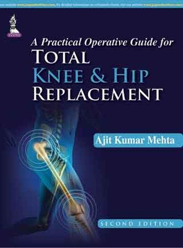 Бумажная книга «A Practical Operative Guide for Total Knee and Hip Replacement», автор Аджит Кумар Мехта - фото №1