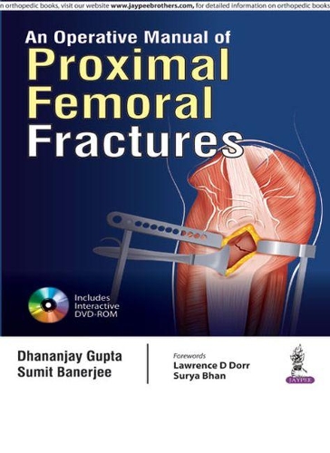 [object Object] «An Operative Manual of Proximal Femoral Fractures», авторів Дхананджай Гупта, Суміт Банерджі - фото №1