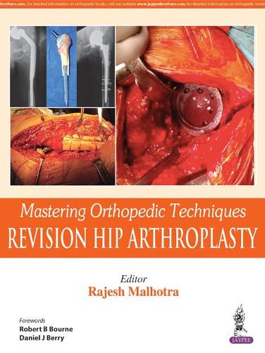 Паперова книга «Mastering Orthopedic Techniques: Revision Total Hip Arthroplasty», автор Раджеш Малхотра - фото №1