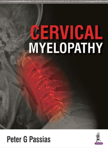 Паперова книга «Cervical Myelopathy», автор Пітер Пассіас - фото №1