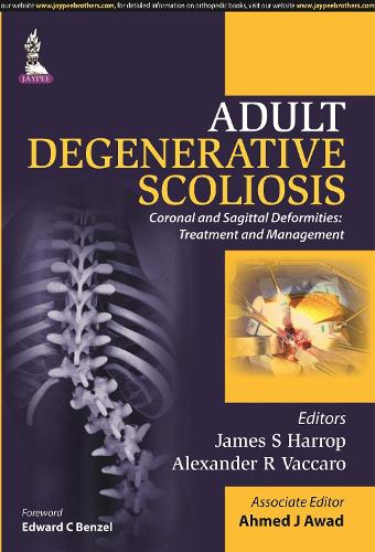 Бумажная книга «Adult Degenerative Scoliosis», авторов Ахмед Дж. Авад, Александр Р Ваккаро, Джеймс С. Харроп - фото №1