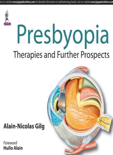 Бумажная книга «Presbyopia: Therapies and Further Prospects», автор Ален-Николя Жильг - фото №1