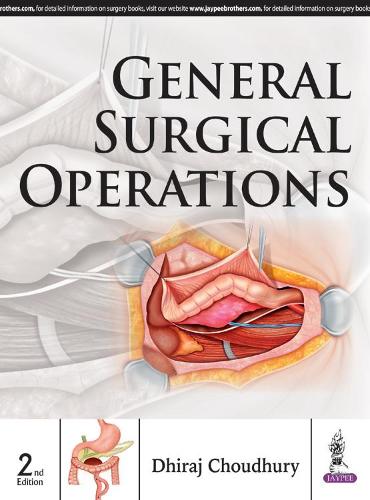 Бумажная книга «General Surgical Operations», автор Дхирадж Чоудхури - фото №1