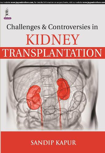 [object Object] «Challenges and Controversies in Kidney Transplantation», автор Сандип Капур - фото №1
