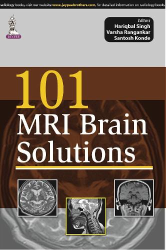 Бумажная книга «101 MRI Brain Solutions», авторов Харикбал Сингх, Сантош Конде, Варша Анганкар - фото №1