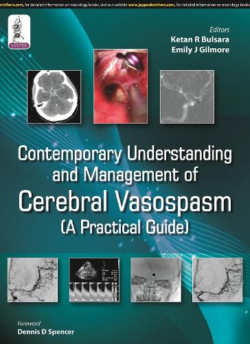 Бумажная книга «Contemporary Understanding and Management of Cerebral Vasospasm», авторов Дж Гилмор Эмили, Кетан Р Булсара - фото №1