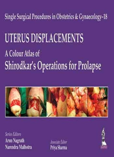 [object Object] «Single Surgical Procedures in Obstetrics and Gynaecology - 18: UTERUS DISPLACEMENTS: A Colour Atlas of Shirodkar's Operations for Prolapse», авторов Арун Награтх, Нарендра Мальхотра, Прия Шарма - фото №1