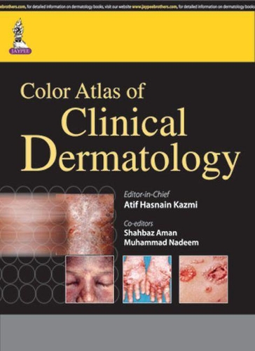Паперова книга «Color Atlas of Clinical Dermatology», авторів Атіф Хаснайн Казмі, Мухаммад Надім, Шахбаз Аман - фото №1