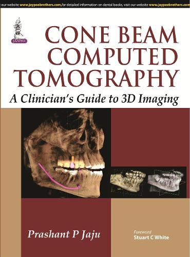 Бумажная книга «Cone Beam Computed Tomography», автор Прашант П. Джаджу - фото №1