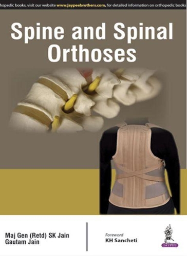 Бумажная книга «Spine and Spinal Orthosis», авторов Гаутам Джайн, С. К. Джайн - фото №1